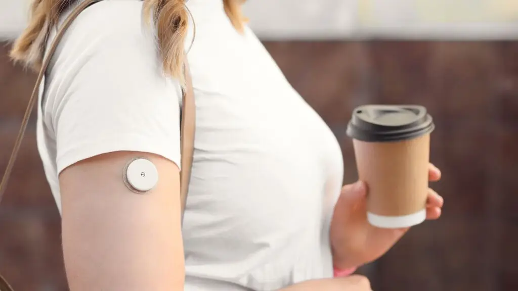 Sensore per il monitoraggio continuo della glicemia nel diabete di tipo 1